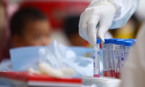 Việt Nam cán mốc 1 triệu xét nghiệm Covid-19 bằng phươg pháp PCR